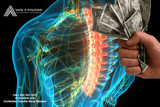 Spinal Cord Injury Attorney In Arizona