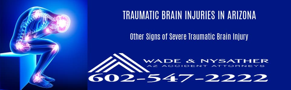 Graphic Stating Other Signs of Traumatic Brain Injury In Arizona